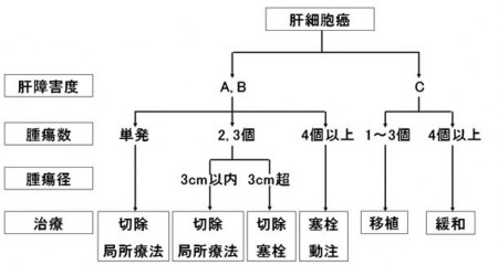 肝がん　治療アルゴリズム